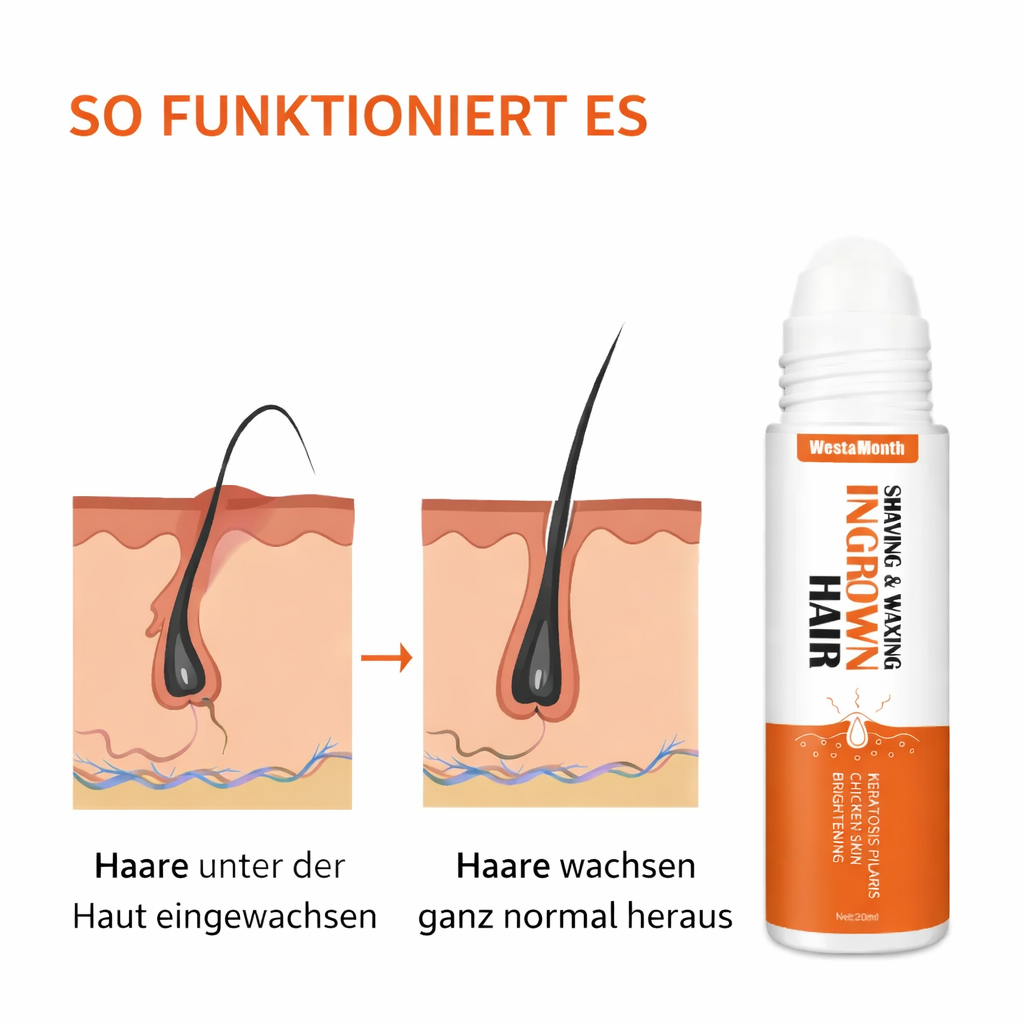 West&Month Ingrown Hair Roll-On Celessé – Gegen eingewachsene Haare & Rasurpickel | Celessé